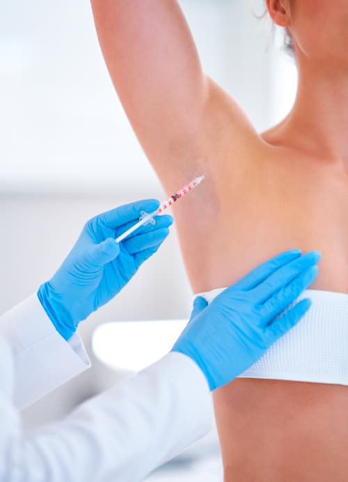 Treatment BOTOX HYPERHIDROSIS