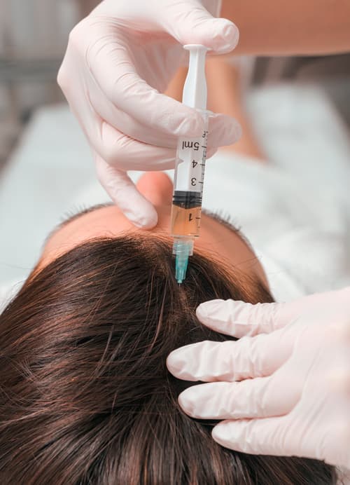 Treatment PRP Hair