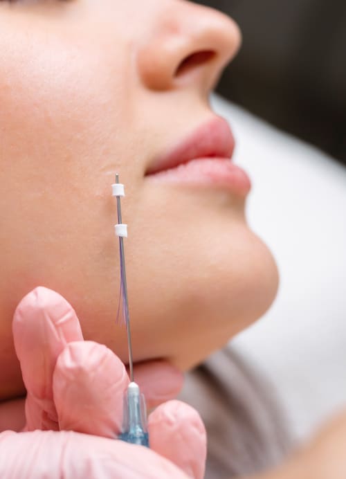 Treatment Radiesse