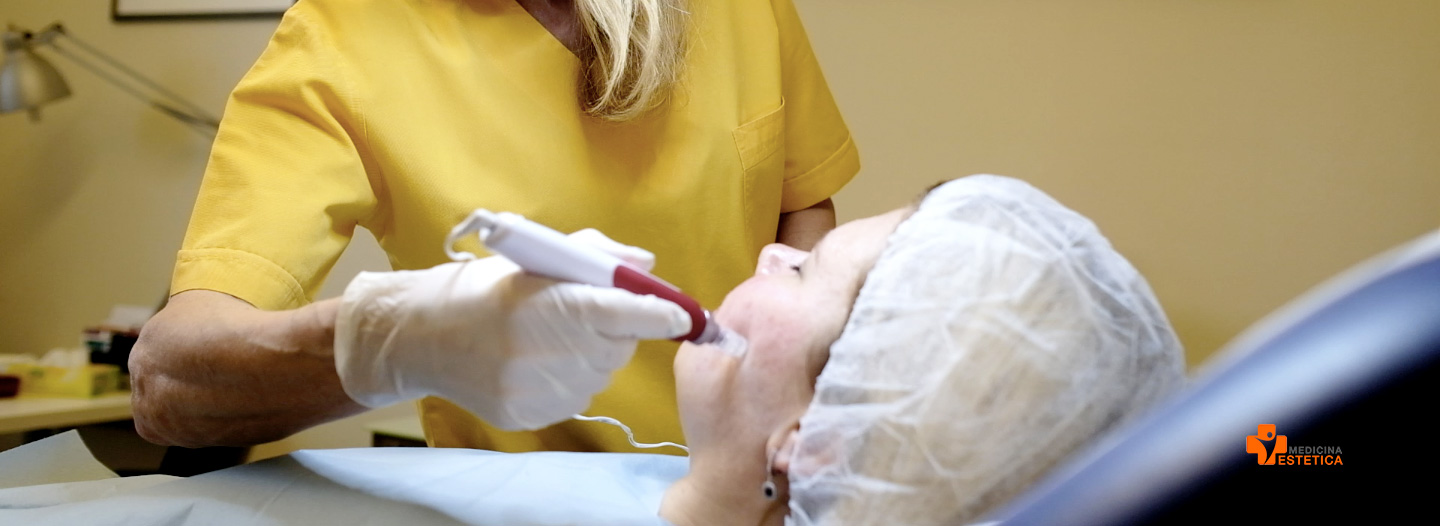 Needling – für eine dauerhaft schöne Haut!