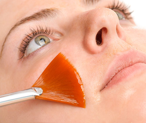 Gesichtsbehandlungen: Chemisches Peeling