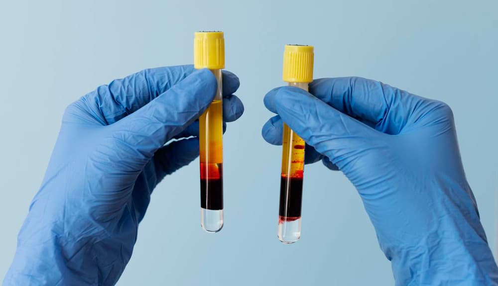 PRP Regenerative Therapie Gesicht PRP Regenerative Therapie Gesicht