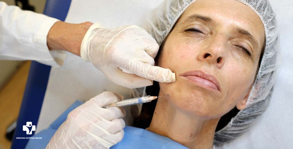 radiesse treatment
